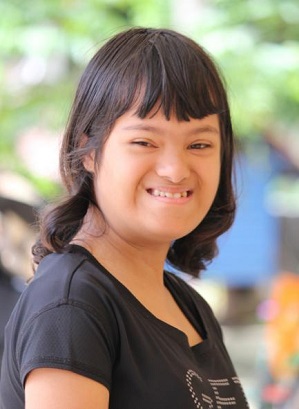 DOWN SYNDROME In Jodhpur